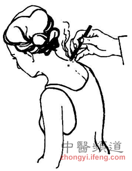 點(diǎn)擊將在新窗口查看全圖 小孩也可以艾灸保健 但要注意5點(diǎn)