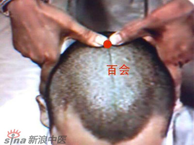 艾灸常用的保健穴有哪些？--百會(huì )