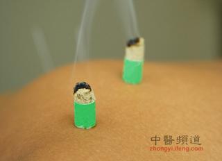 中醫艾灸養生的十大禁忌