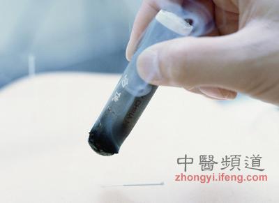 中醫艾灸養生的十大禁忌