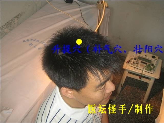 王文遠平衡針灸穴位圖 - 3396815 - 3396815博愛(ài)