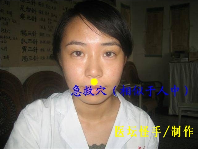 王文遠平衡針灸穴位圖 - 3396815 - 3396815博愛(ài)