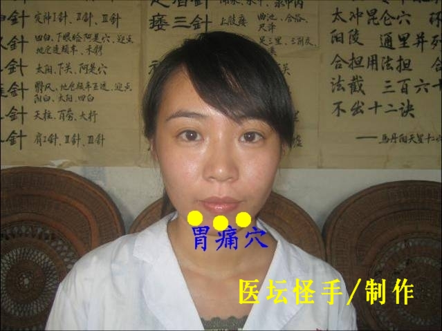 王文遠平衡針灸穴位圖 - 3396815 - 3396815博愛(ài)