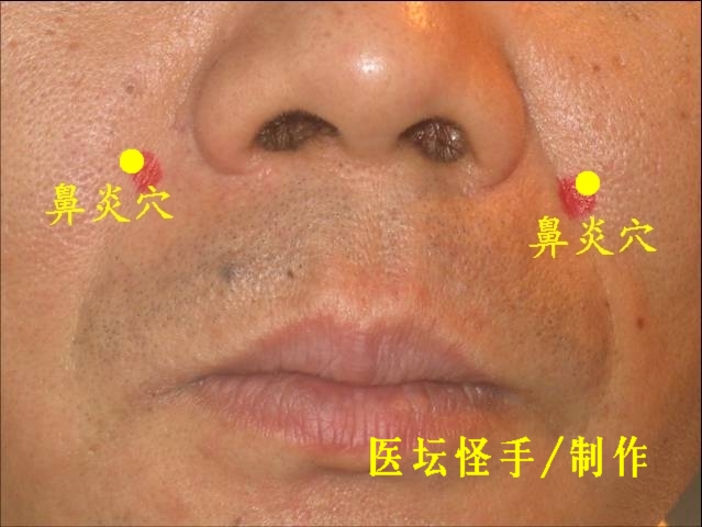 王文遠平衡針灸穴位圖 - 3396815 - 3396815博愛(ài)