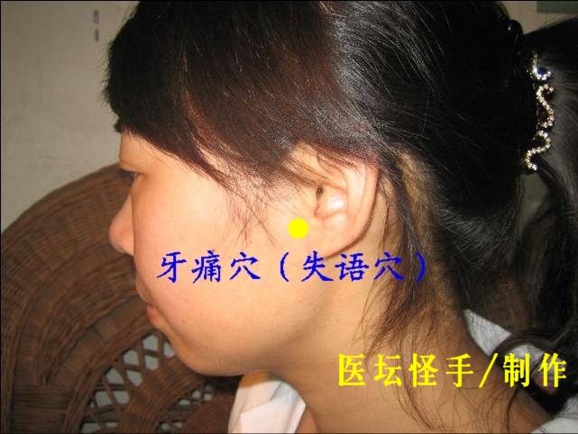 王文遠平衡針灸穴位圖 - 3396815 - 3396815博愛(ài)