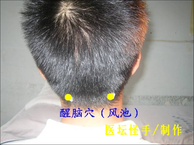 王文遠平衡針灸穴位圖 - 3396815 - 3396815博愛(ài)