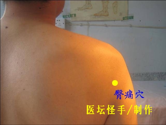 王文遠平衡針灸穴位圖 - 3396815 - 3396815博愛(ài)