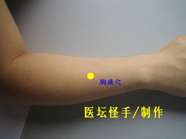 王文遠平衡針灸穴位圖 - 3396815 - 3396815博愛(ài)