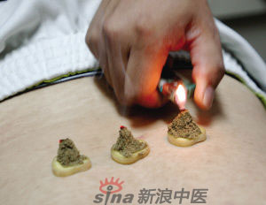 灸法的種類(lèi)  你知道多少？