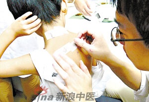 灸法的種類(lèi)  你知道多少？
