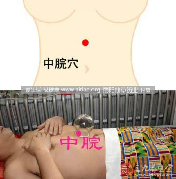 中脘穴位于腹部正中線(xiàn)，臍上4寸的位置上。每天艾灸10-15分鐘，能有效緩解胃部不適的癥狀，同時(shí)有助于祛濕。
